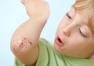 What is a scab?