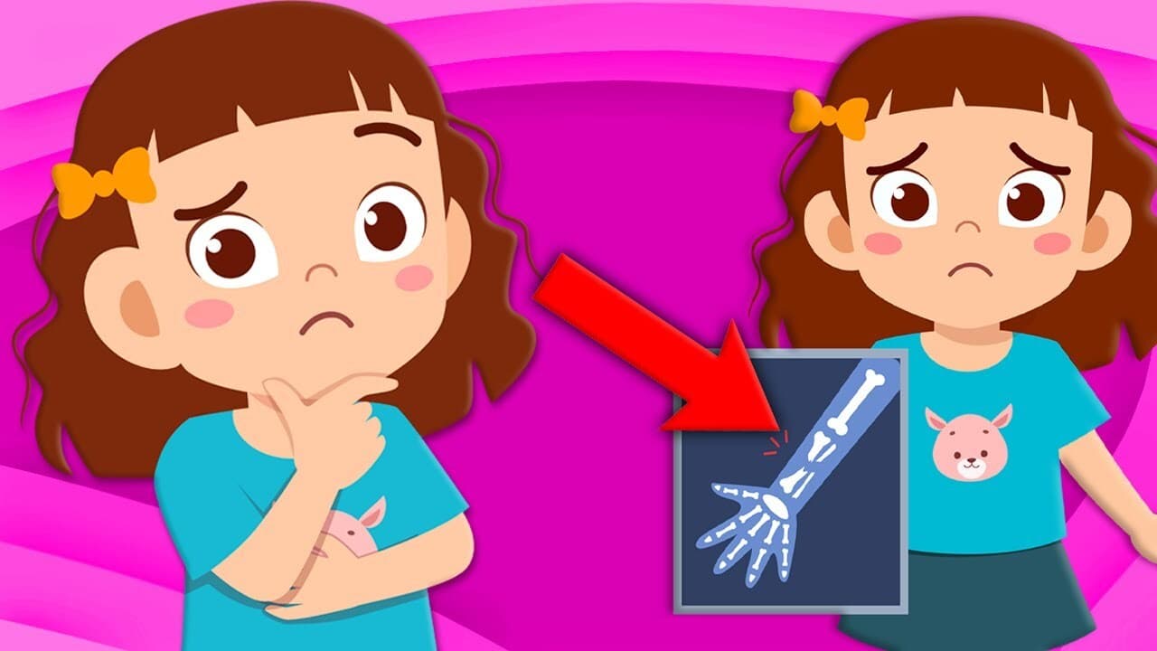 Learn How Broken Bones Heal!