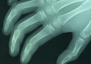 Function of the skeleton