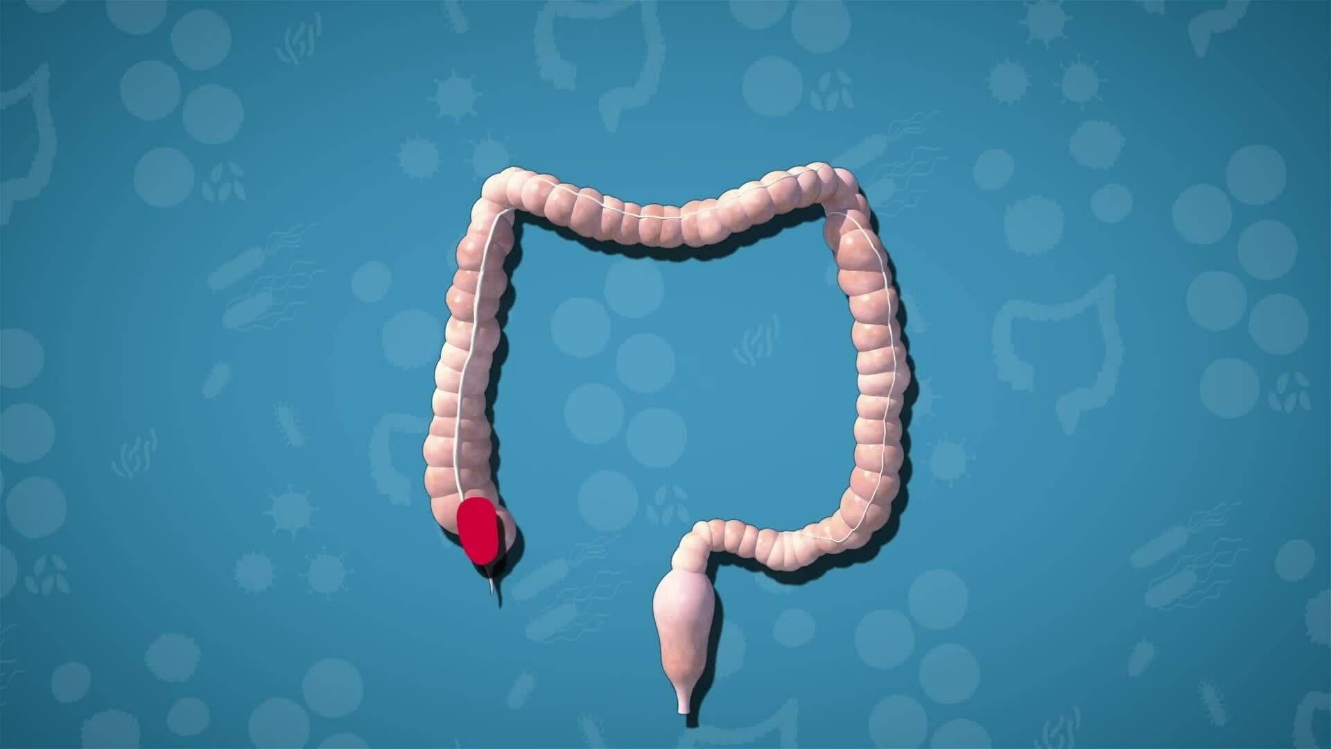 I WONDER - How Does The Colon Get Rid Of Waste?