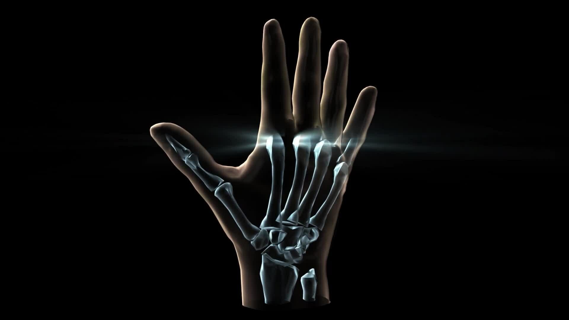 I WONDER - What Are The Different Types Of Joints?