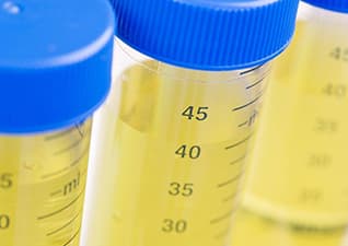 Why is urine yellow?