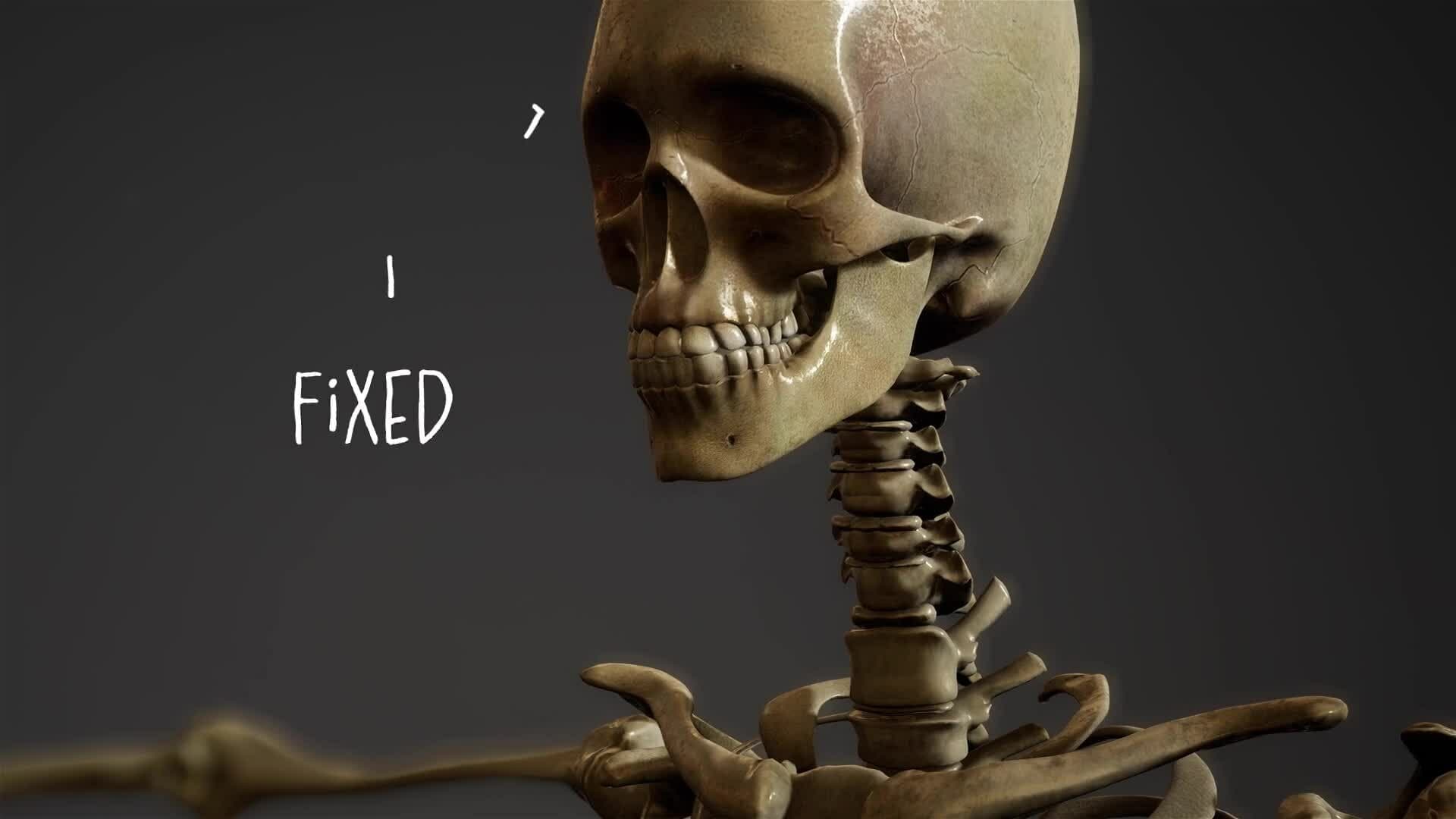 I WONDER - Do All Joints Move?