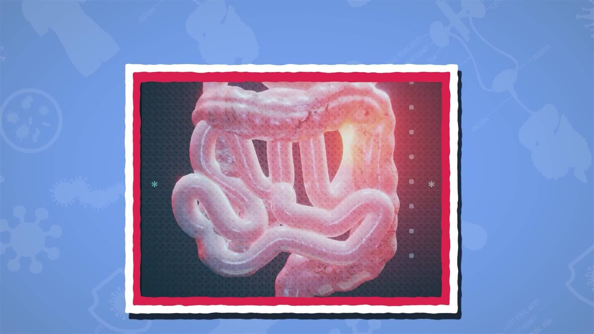 I WONDER - What Is Peristalsis?