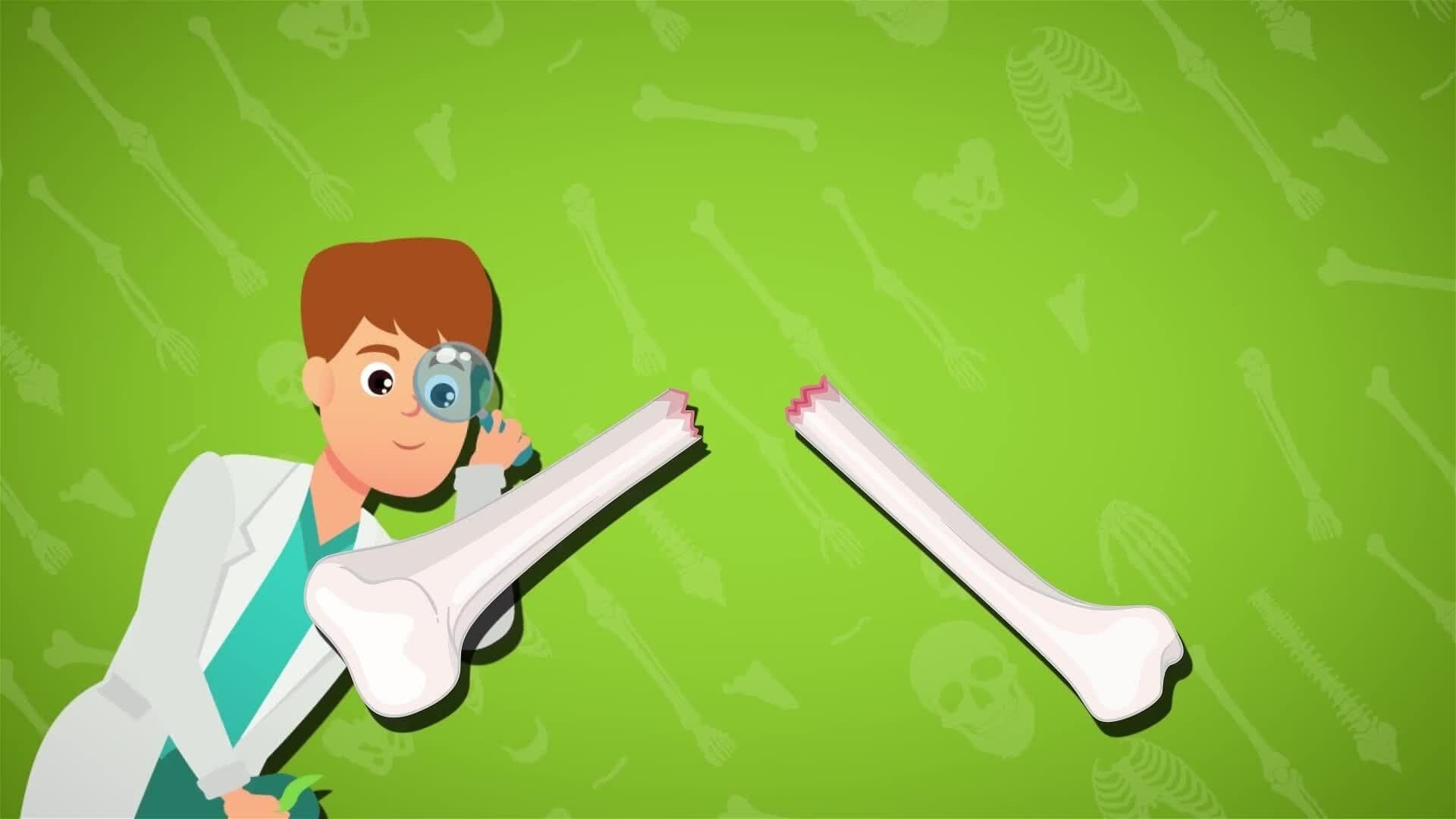 I WONDER - What Is A Bone Fracture?