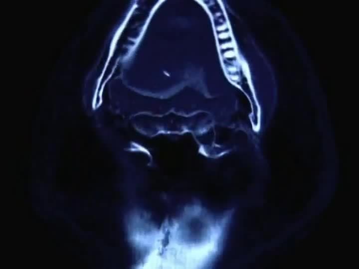 Virtual Archaeology: How Computer Tomography Changed Archaeology