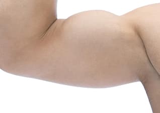 Acquired characteristics