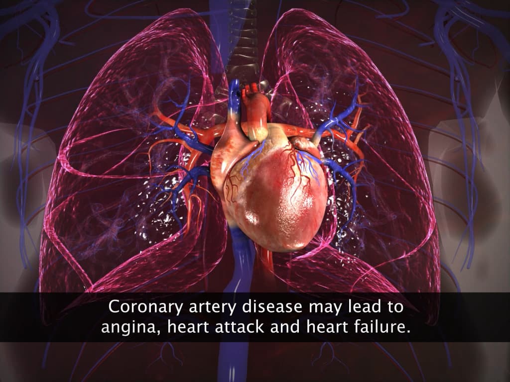 Disorders of the Circulatory System