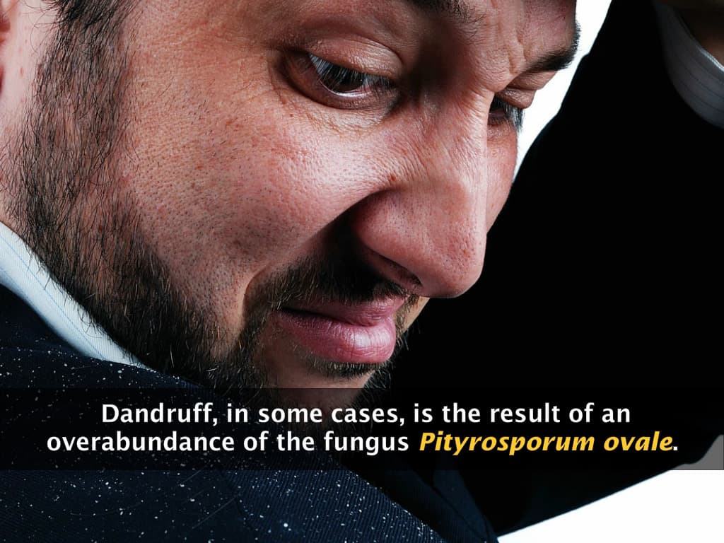 Common Fungal Diseases in Humans