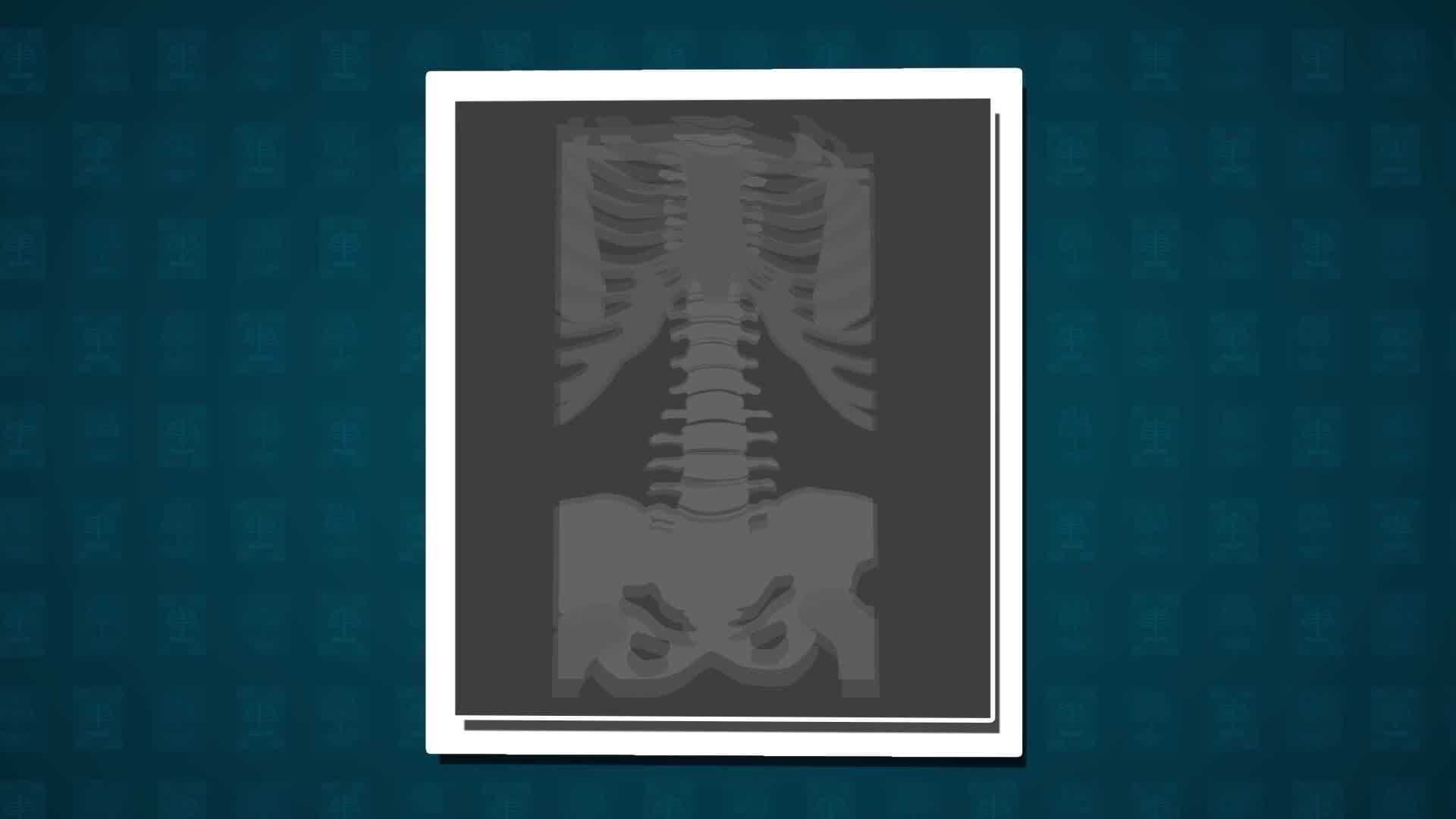 How Does it Work? - X-rays