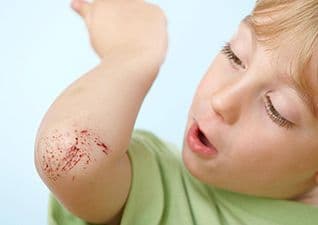 What is a scab?