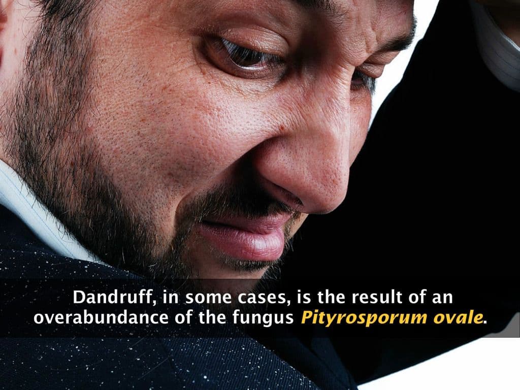 Common Fungal Diseases in Humans